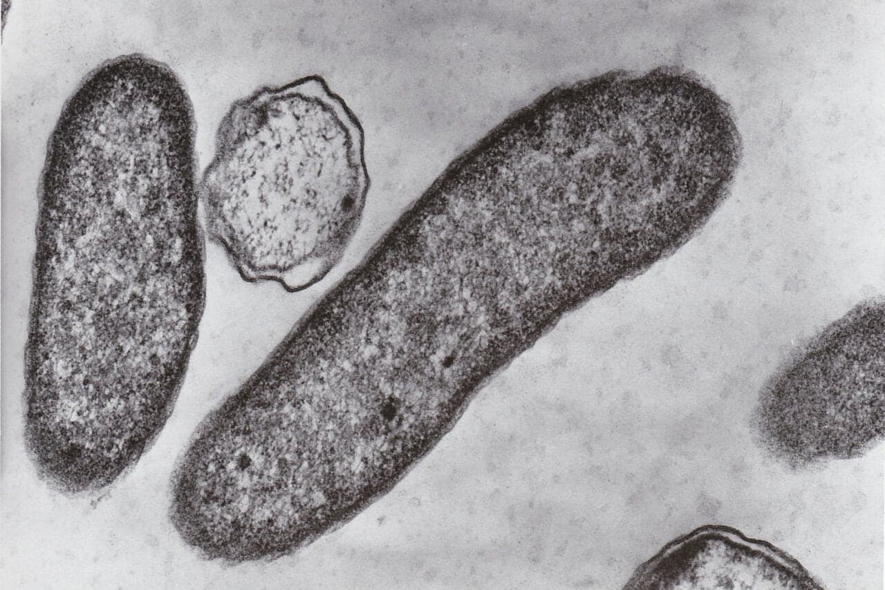 Teen Fighting for Life After Catching ‘Flesh-Eating’ Bacteria From Florida Park
