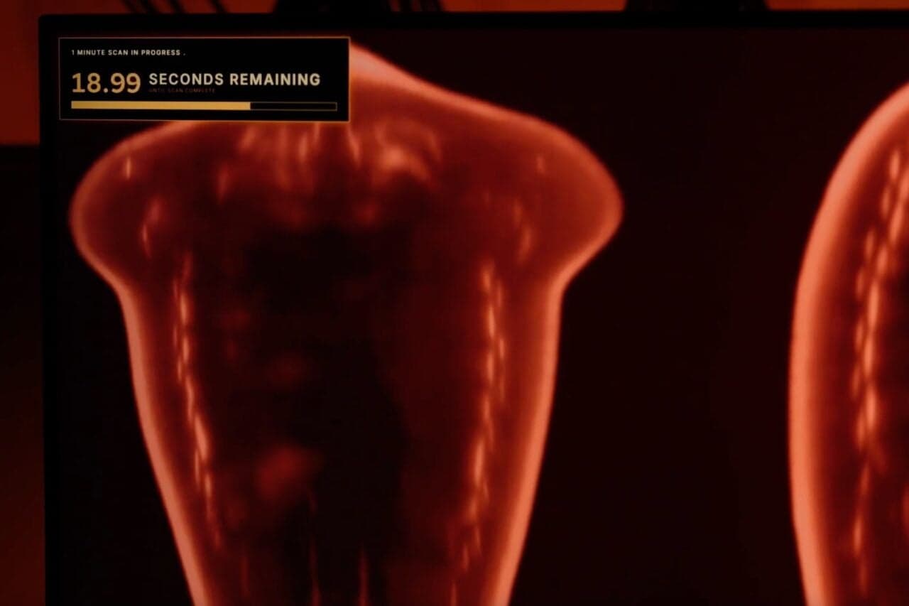 Midjourney Unveils Breakthrough Medical Scanner, Set to Outpace Traditional MRI Technology