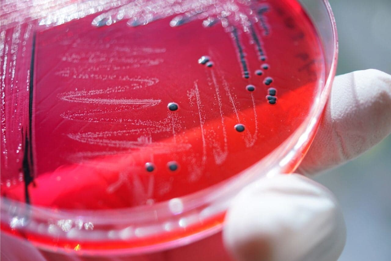 Tainted Food Is Killing Far More People Than Previously Thought, WHO Says