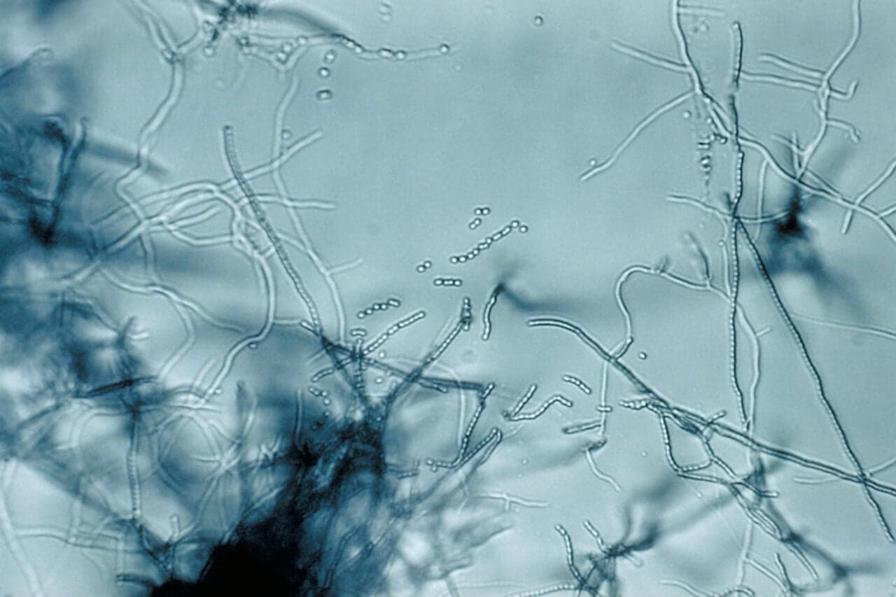 New Antibiotic Found in Dirt Targets Superbugs in a Way ‘Never Been Seen Before’