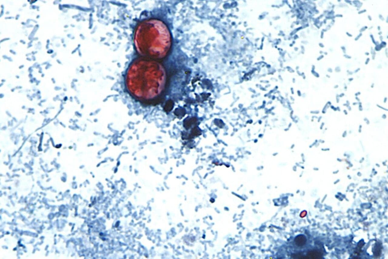 Oh Great, a Parasite That Causes Explosive Diarrhea Is Spreading Right Now