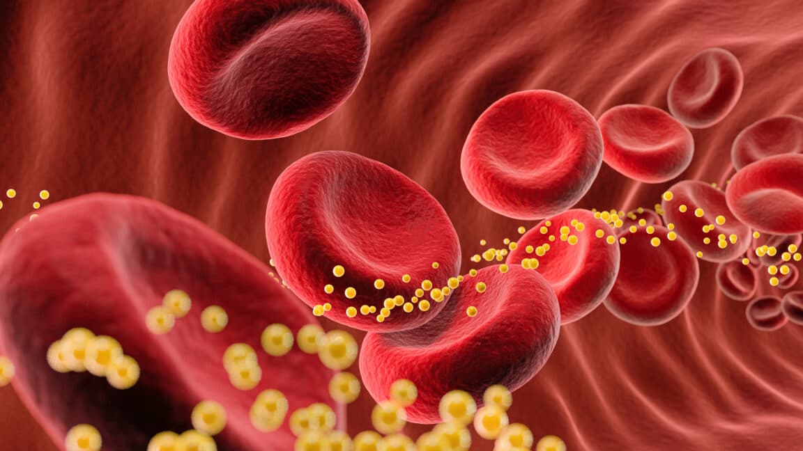 Gene-editing treatment reduces bad cholesterol by 62% in small study