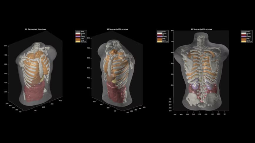 Midjourney unveils groundbreaking full-body scanner, surpassing MRI technology.