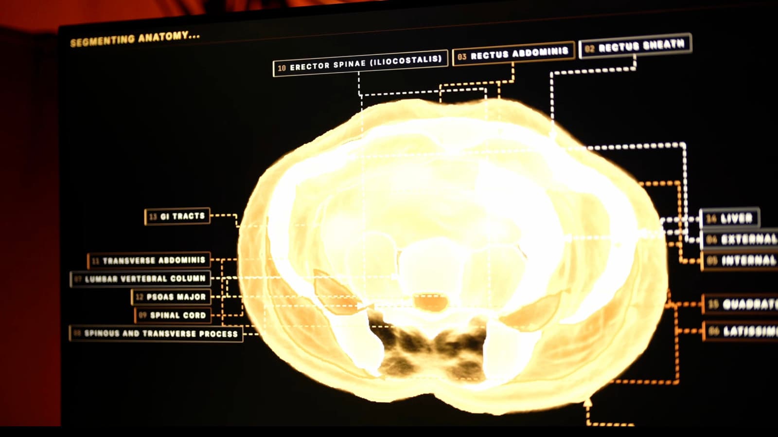 Midjourney Unveils Ambitious Plan for Revolutionary Ultrasonic Body Scanning Technology